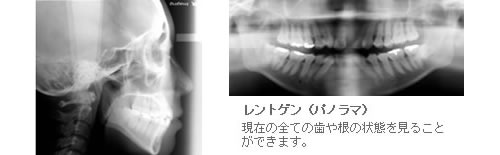 矯正治療について